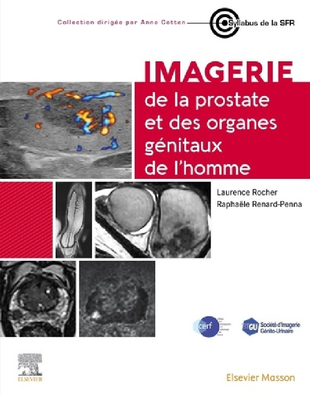 Couverture du syllabus SFR/SIGU sur l’imagerie prostatique et génitale masculine